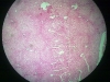 liver-1
