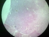 liver-2