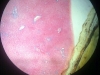 liver-3