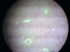 liver-4