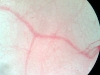 loose-aerolar-connective-tissue-2