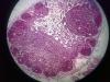 lymph-node-1