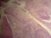 Palatine Tonsils