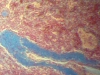 Spleen