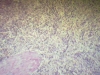 Spleen
