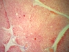 Thymus