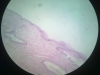 metaplasia-2