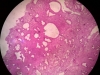 metaplasia-6