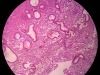 metaplasia-7