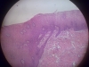 metaplasia-8