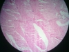 skeletal-muscle