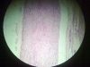 nerve-2