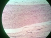 nerve-3