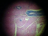 pancreas-1