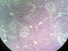 pancreas-2