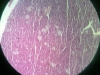 pancreas-3