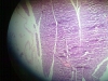 pancreas-4