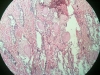 prostate-gland-1