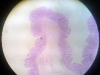 rectum-mucosa-n-sub-mucosa