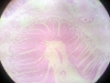 Rectum muscularis externa and adventitia