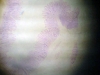 Rectum