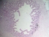 seminal-vesicle-2