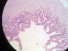 seminal-vesicle