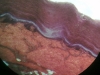Skin -2