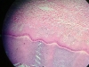 Skin -3