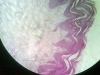 Skin -4