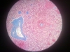 spleen-2
