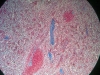 spleen-4