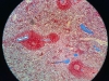 spleen-5