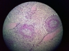 spleen-6