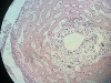 spongy-bone-11