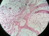 spongy-bone-12