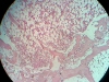 spongy-bone-6