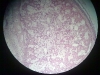 spongy-bone-3