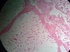 spongy-bone-2