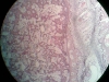 spongy-bone-1