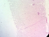 Stomach-1