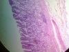 stomach-2