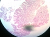 Stomach-5