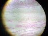 Stomach-pylorus