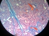 submaxillary-gland-2