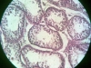 testes-4