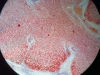 thymus-1