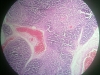 thymus-2