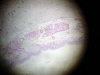 trachea-1