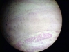 trachea-2